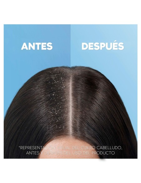 Shampoo Head & Shoulders H&S Citrus Fresh Greasy hair 1 L