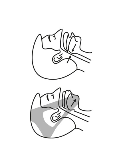 Anti-snoring Band Stosnore InnovaGoods