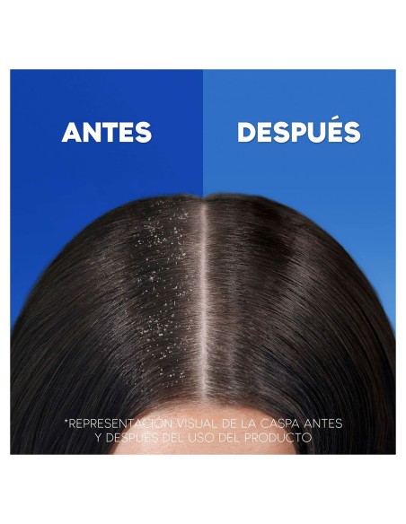 Shampoo Head & Shoulders H&S Clásico 1 L