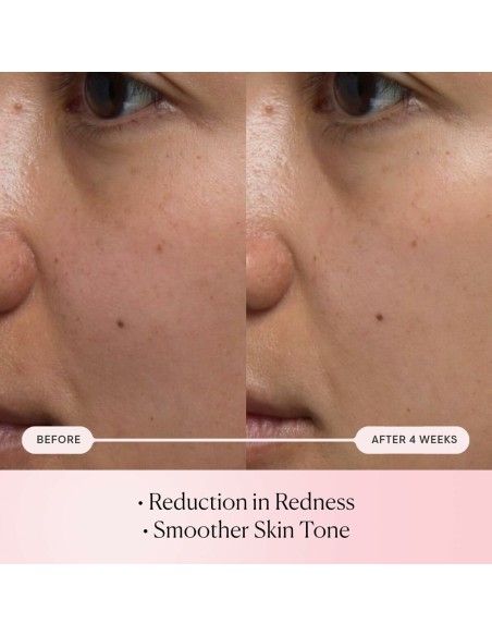 Facial Serum Elemis