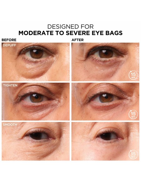 Cream for Eye Area It Cosmetics Bye Bye 15 ml