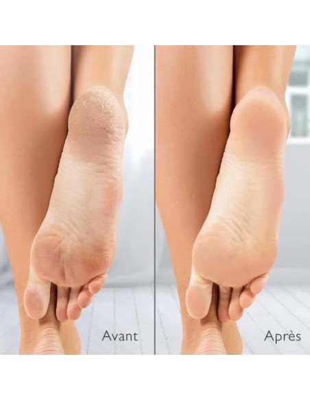 Electric Callus Remover Silk´n Vacupedi (5 Units)
